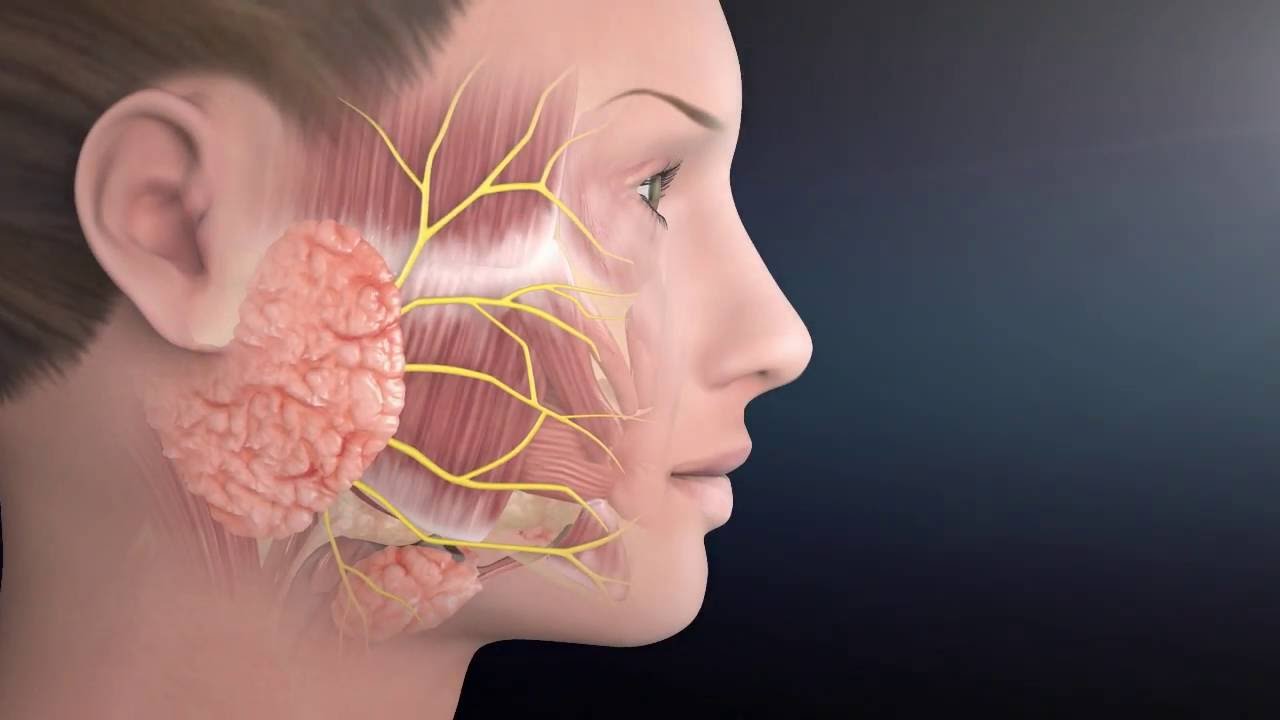 Salivary gland tumor