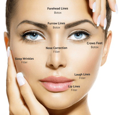 Botox: Areas of Interest