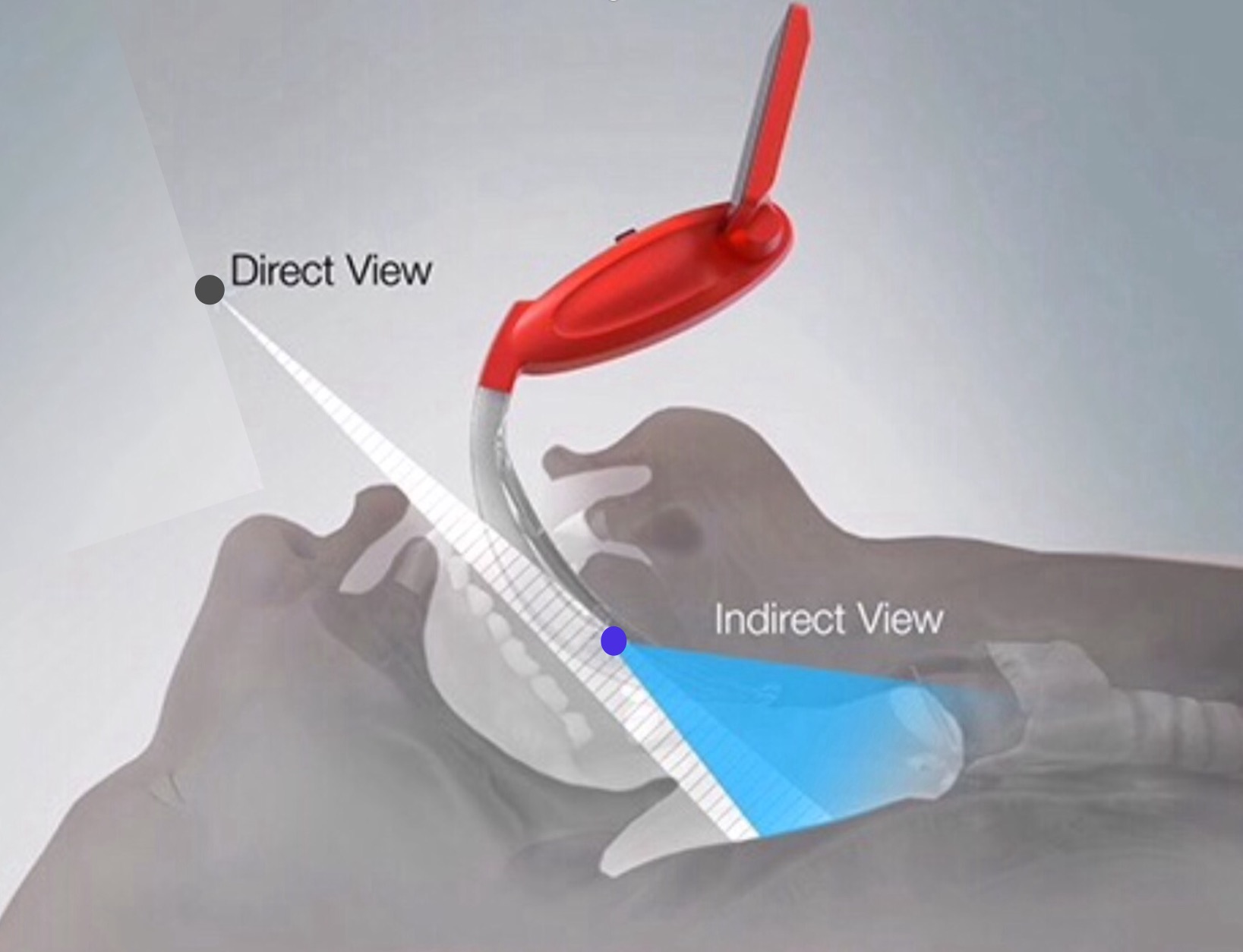 Laryngoscopy