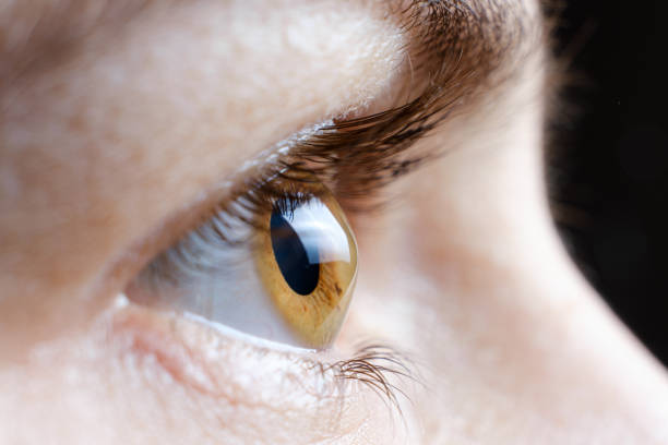 Riverside City College assistant professor of nursing Kristin Fontaine with a picture of her infected left eye before the cornea transplant in April 2015